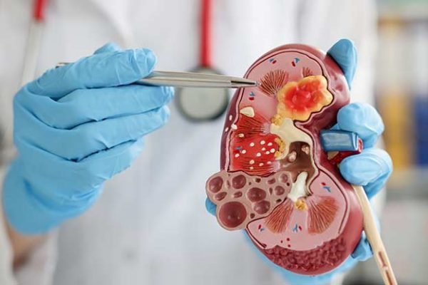 24214-nephrologist 24214-nephrologist