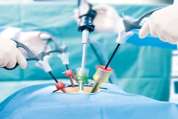 laparoscopic-surgery-1 laparoscopic-surgery-1