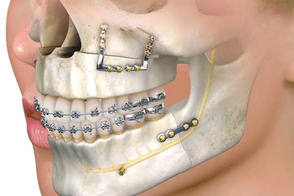 oral-maxillofacial oral-maxillofacial
