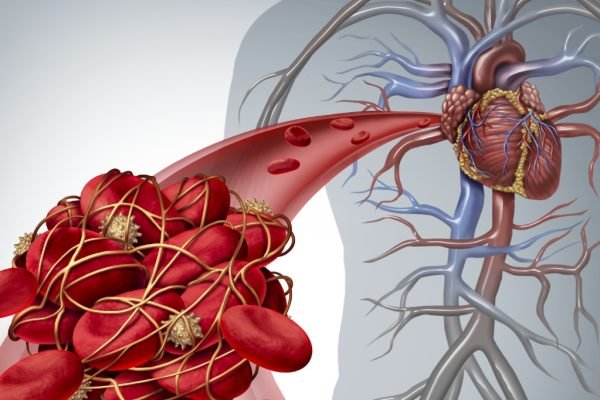 vascular-health-during-the-covid-19-pandemic